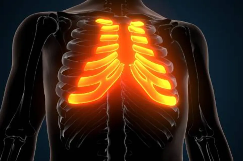What Is Rib Flare and Why It Happens?
